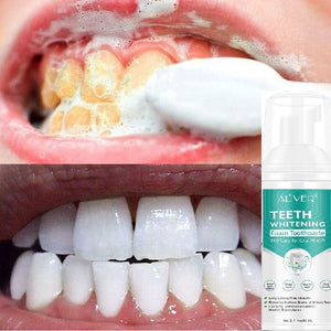 Teeth Whitening Toothpaste Foam Natural Ingredients Baking Soda Teeth Whitener