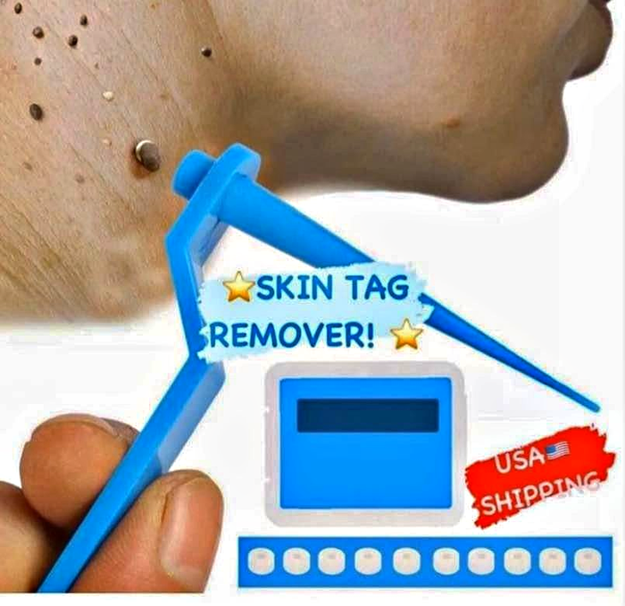 Micro Safe Skin Tag Remover Kit for Fast & Effective Skin Tag Removal