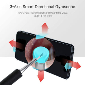 Wireless Ear Wax Removal Tool, Ear Cleaner, Camera 1080P FHD Otoscope