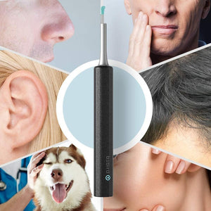 Wireless Ear Wax Removal Tool, Ear Cleaner, Camera 1080P FHD Otoscope