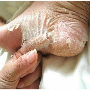 Foot Peel Mask Baby Soft Feet Calluses Dead Dry Skin Cracked Heel Repair, 2 Pack
